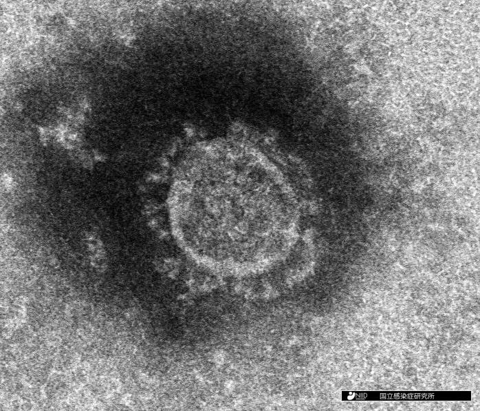 新型コロナウイルスの顕微鏡写真